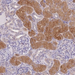 OR5T1 Antibody, Novus Biologicals 25ul | Buy Online | Novus Biologicals | Fisher Scientific